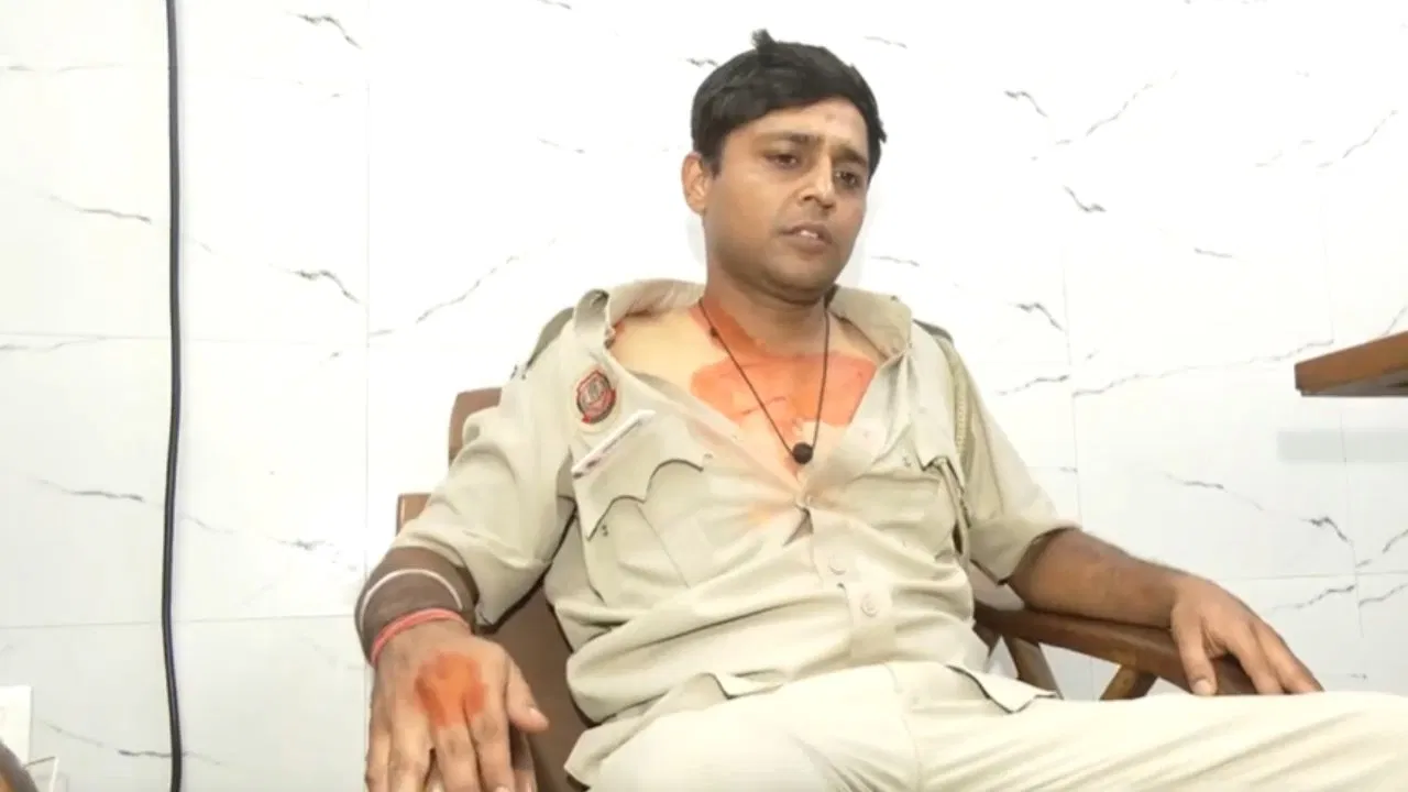 कांस्टेबल अंकित कसाना पर कांग्रेस प्रदर्शन में 40-50 प्रदर्शनकारियों ने किया मारपीट, उंगली पर काटा, नाखून से खरोंचा