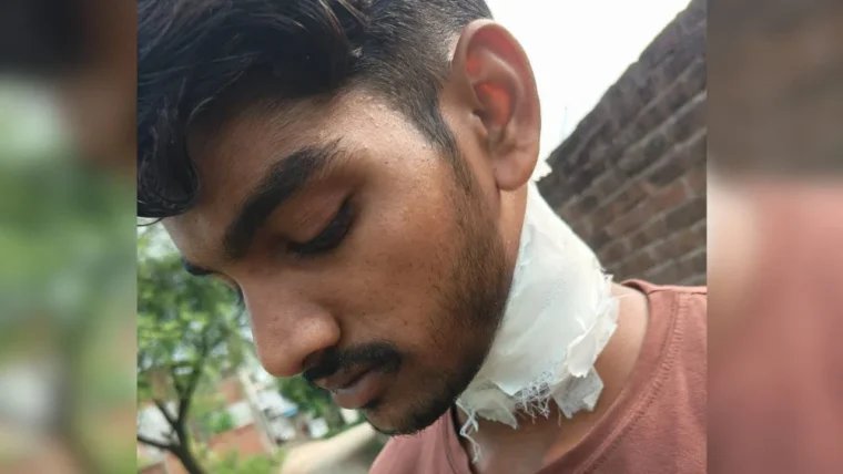 लखनऊ में फिर चाइनीज मांझे का कहर: बाइक सवार के गले में फंसा धागा, चार टांके
