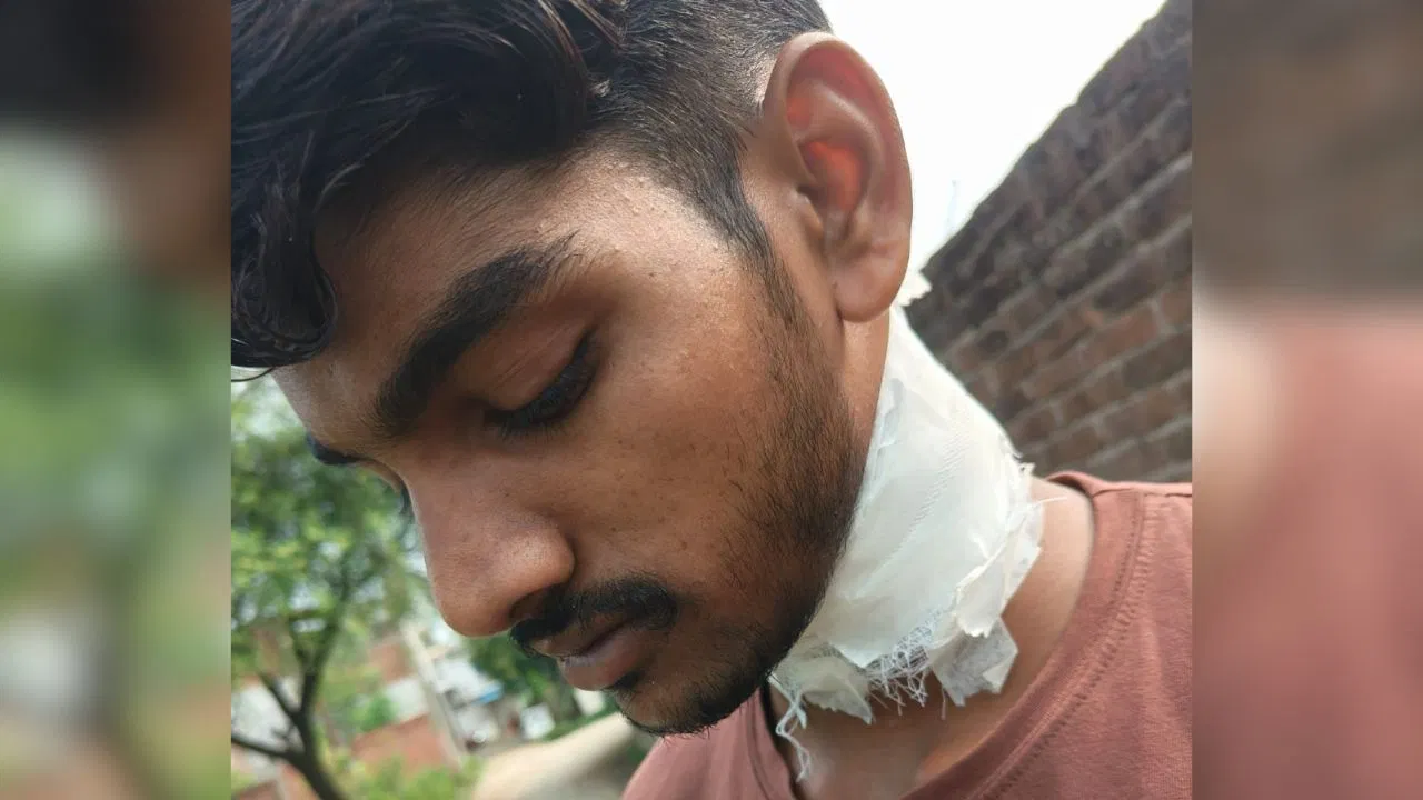 लखनऊ में फिर चाइनीज मांझे का कहर: बाइक सवार के गले में फंसा धागा, चार टांके
