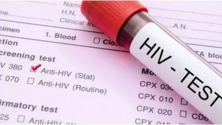 वाराणसी में HIV मामलों में तेज़ी, 9 महीनों में 300 से अधिक नए पॉजिटिव, युवा वर्ग सबसे अधिक प्रभावित