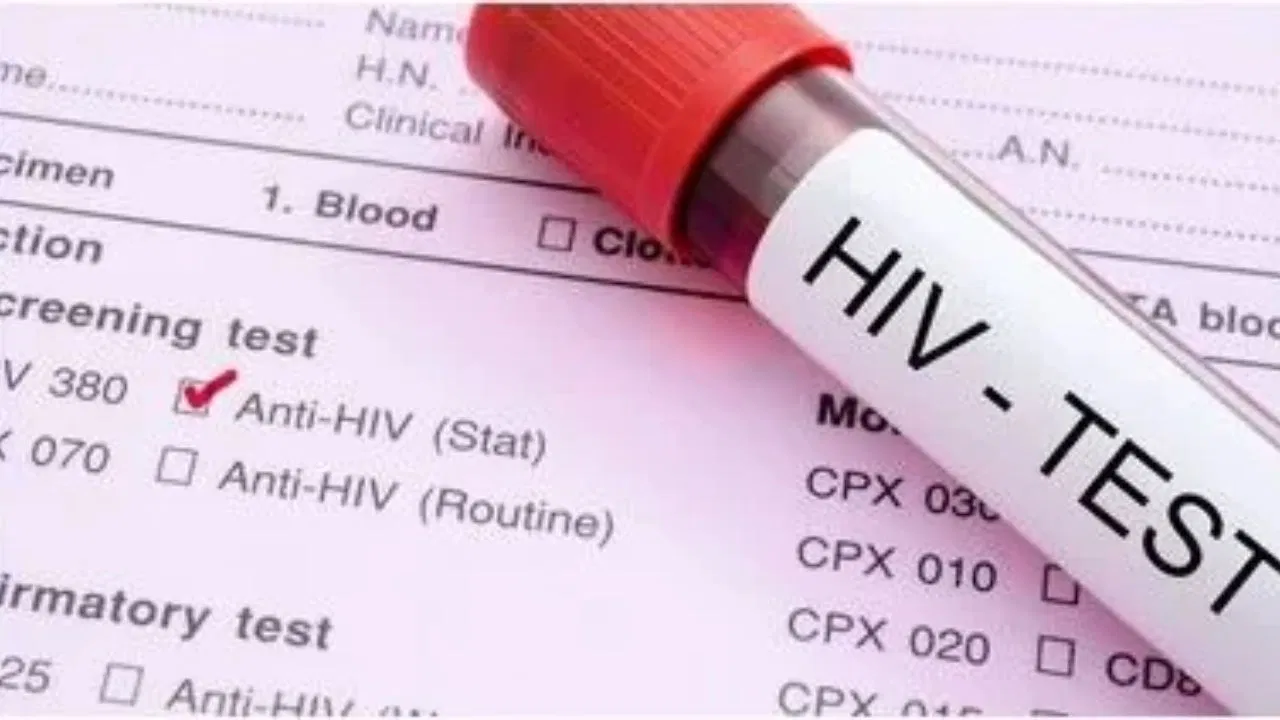 वाराणसी में HIV मामलों में तेज़ी, 9 महीनों में 300 से अधिक नए पॉजिटिव, युवा वर्ग सबसे अधिक प्रभावित
